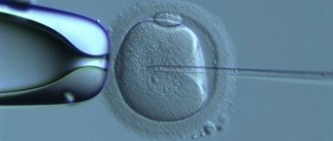 Microiniezione degli ovociti donati con spermatozoi del partner.